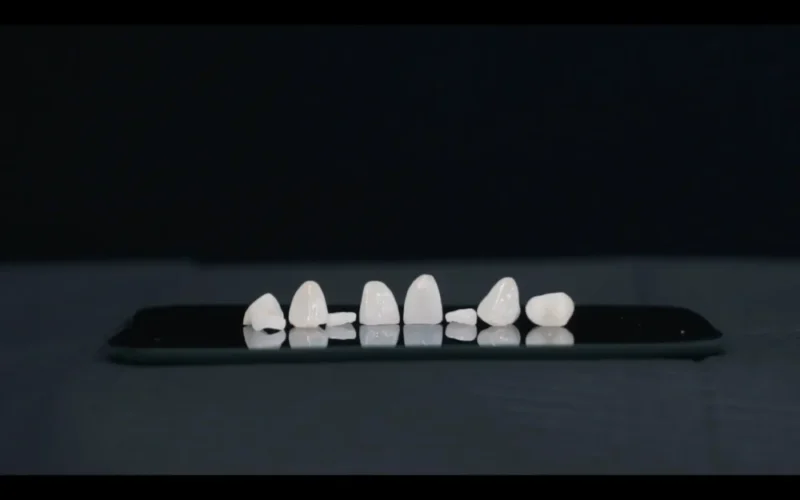 Picture of a set of 8 emax dental crowns on a black mirror tray against a dark background