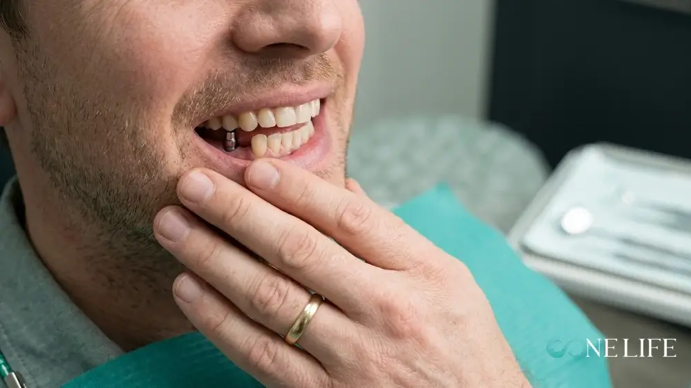 A close-up photograph of a man in a dental chair, with his hand with a wedding ring resting on his jaw as he looks down at his mouth with a slight smile; a single titanium dental implant abutment is visible on his gums where a lower tooth is missing.