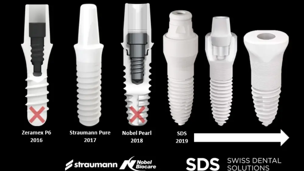 Evolution of zirconia teeth implants (last 10 years up to 2026)