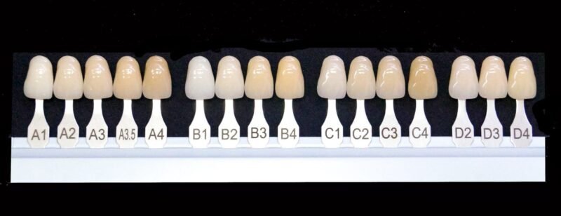 Pictures displaying the full color palette of the VITA teeth shade guide