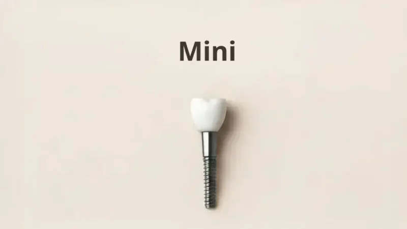 Picture of a single mini dental implant against a beige background