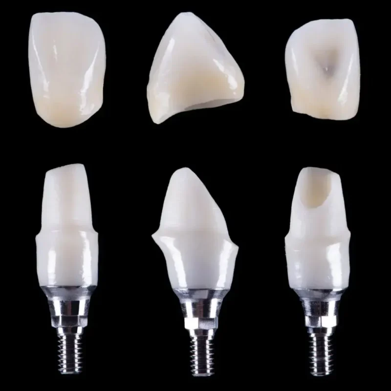 3 custom dental abutments (for incisor teeth, molar and canine) floating over a black background.