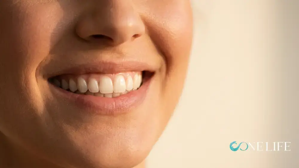 Close-up of a young female patient's mouth smiling after receiving composite bonding in Turkey.