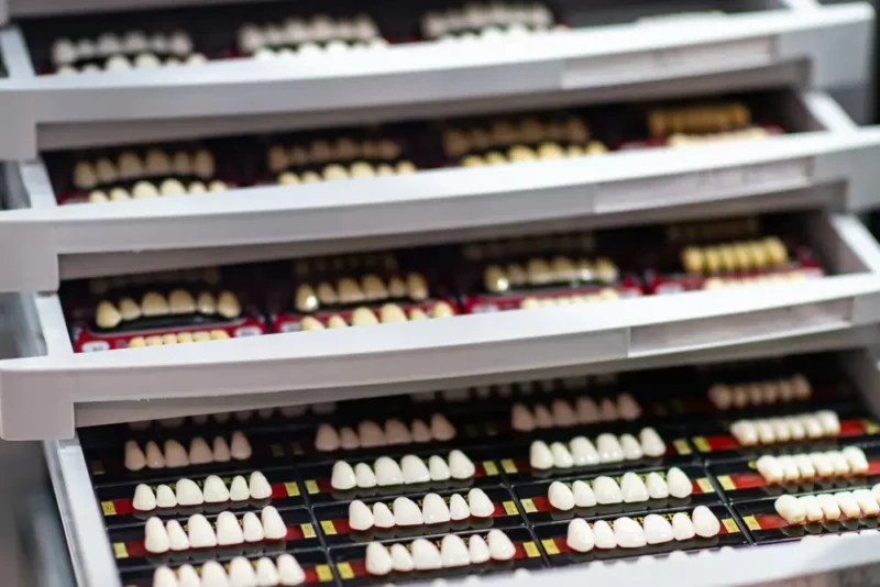 Open storage drawers in a dental laboratory filled with organized trays of artificial teeth, displaying a wide variety of dental color shades.