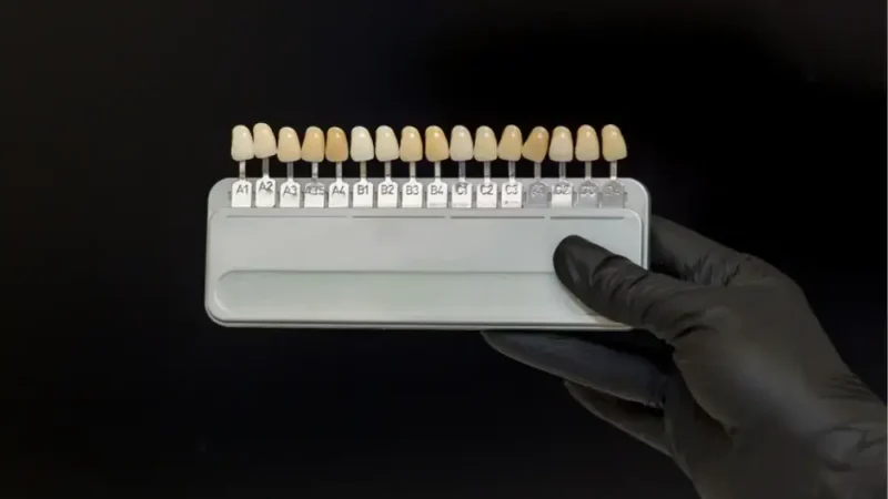 A professional dental shade guide held by a hand wearing a black glove against a dark background.
