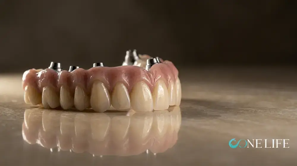 Image of a fixed dental prosthesis on beige marble against a dark background.