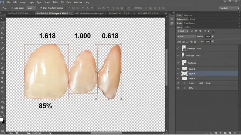 Digital smile design software showing three front teeth measured against golden ratio proportions of 1.618, 1.000 and 0.618.
