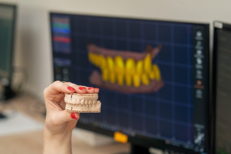 A person with red fingernail polish holds up a precise 3D-printed dental model of a set of human teeth. In the background, a large computer monitor displays a detailed CAD/CAM rendering of the same dental model, showing the digital design and verification process.