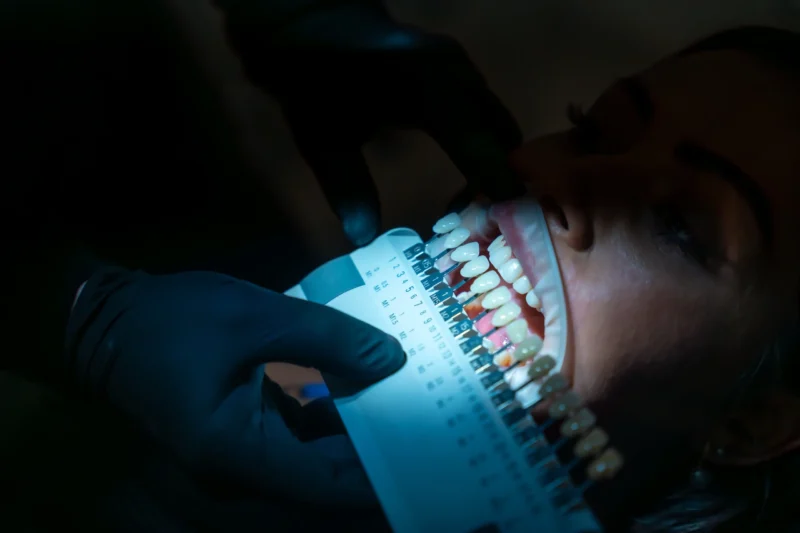 Close-up of a dentist wearing black gloves performing teeth shade identification pre OP on a patient under focused lighting.
