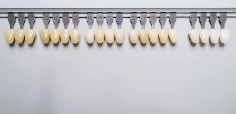 A comprehensive row of human-like dental shade guide samples arranged linearly, spanning a wide color spectrum from deep natural yellow-browns to a final set of very bright 'bleached' white tones.